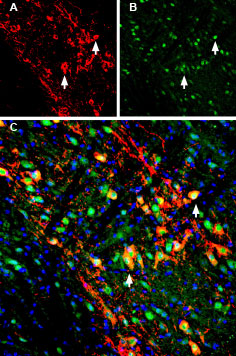 Multiplex staining of GIRK2 (Kir3.2) and LRRK2 in mouse substantia nigra pars compacta 