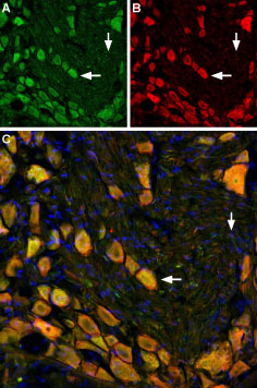 Multiplex staining of NK1 Receptor and mGluR5 in rat DRG
