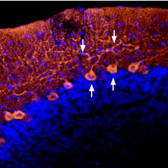 Expression of AGTR1 in rat cerebellum