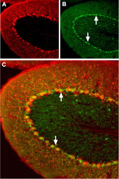 Expression of Angiotensin II Receptor Type-1 in mouse cerebellum