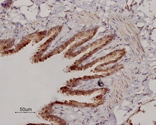 Expression of β2-Adrenoceptor in rat lung