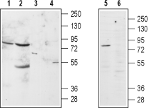 Western blot analysis of α1B-Adrenoceptor in rat brain (lanes 1 and 3), rat kidney (lanes 2 and 4) and GH3 cell line (lanes 5 and 6) lysates: