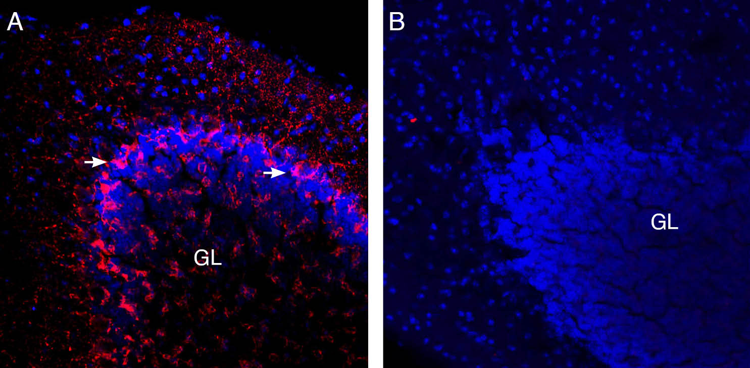 Expression of VGAT in mouse cerebellum. 