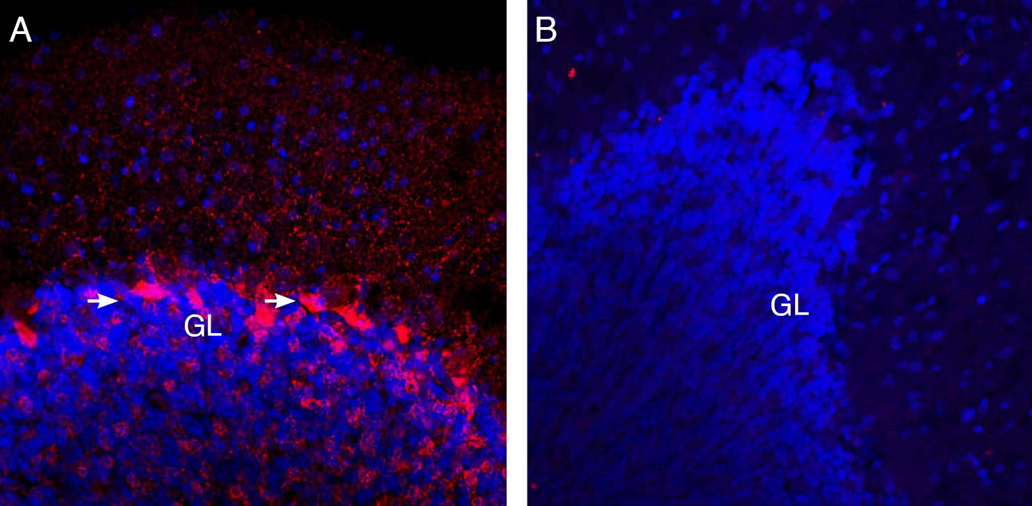 Expression of VGAT in rat cerebellum. 