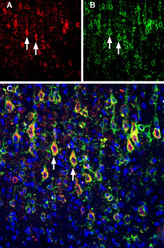 Multiplex staining of Slitrk1 and KV2.1 in rat parietal cortex