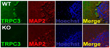 Anti-TRPC3 Antibody