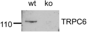 Anti-TRPC6 Antibody