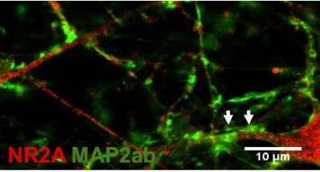 Anti-NMDAR2A (GluN2A) (extracellular) Antibody