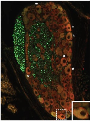 Anti-δ-Opioid Receptor (OPRD1) (extracellular) Antibody