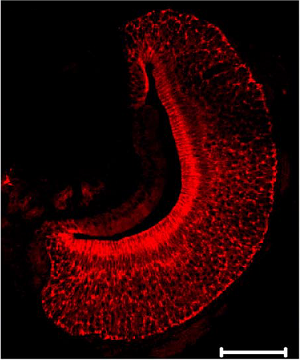 Anti-KCNMA1 (KCa1.1) (1097-1196) Antibody