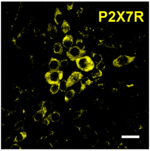 Expression of P2X7 receptor in mouse longitudinal muscle-myenteric plexus sections.