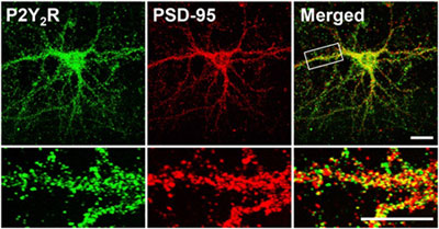 Anti-P2Y2 Receptor Antibody