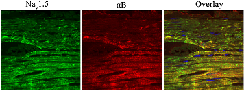 Anti-Nav1.5 (SCN5A) (1978-2016) Antibody