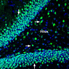 Expression of NHE-6 in rat hippocampus