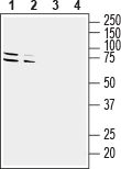 Western blot analysis of mouse (lanes 1 and 3) and rat (lanes 2 and 4) brain lysates: