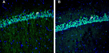 Expression of EphA3 in rat and mouse hippocampus