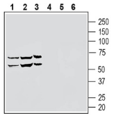  Western blot analysis of human THP-1 monocytic leukemia cell line lysate (lanes 1 and 4), human NK-92 natural killer cell line lysate (lanes 2 and 5) and human HL-60 promyelocytic leukemia cell line lysate (lanes 3 and 6) lysates: 