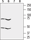 Western blot analysis of human ovary adenocarcinoma OVCAR-3 cell (lanes 5 and 7) and human pancreatic carcinoma PANC-1 cell (lanes 6 and 8) lysates: