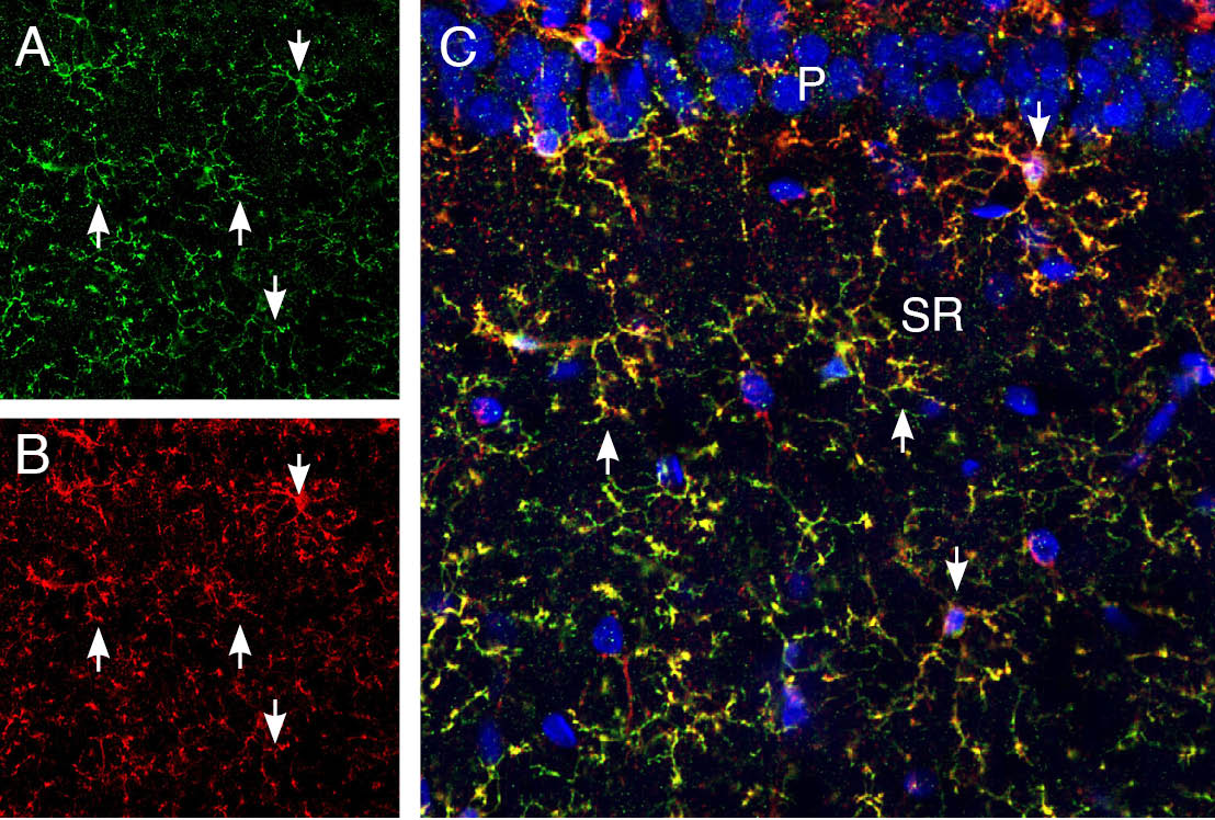 Multiplex staining of CX3CR1 and CD11b in rat hippocampus. 