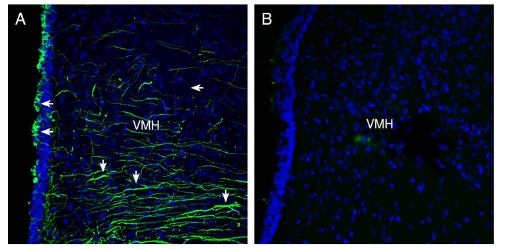 Expression of Semaphorin 4A in rat hypothalamus