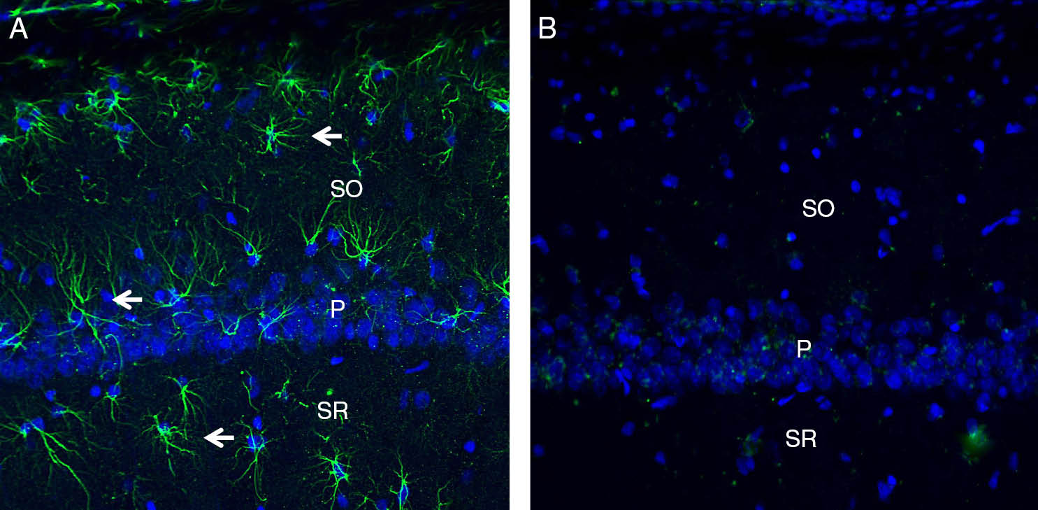 Expression of C5aR2 in rat hippocampus.