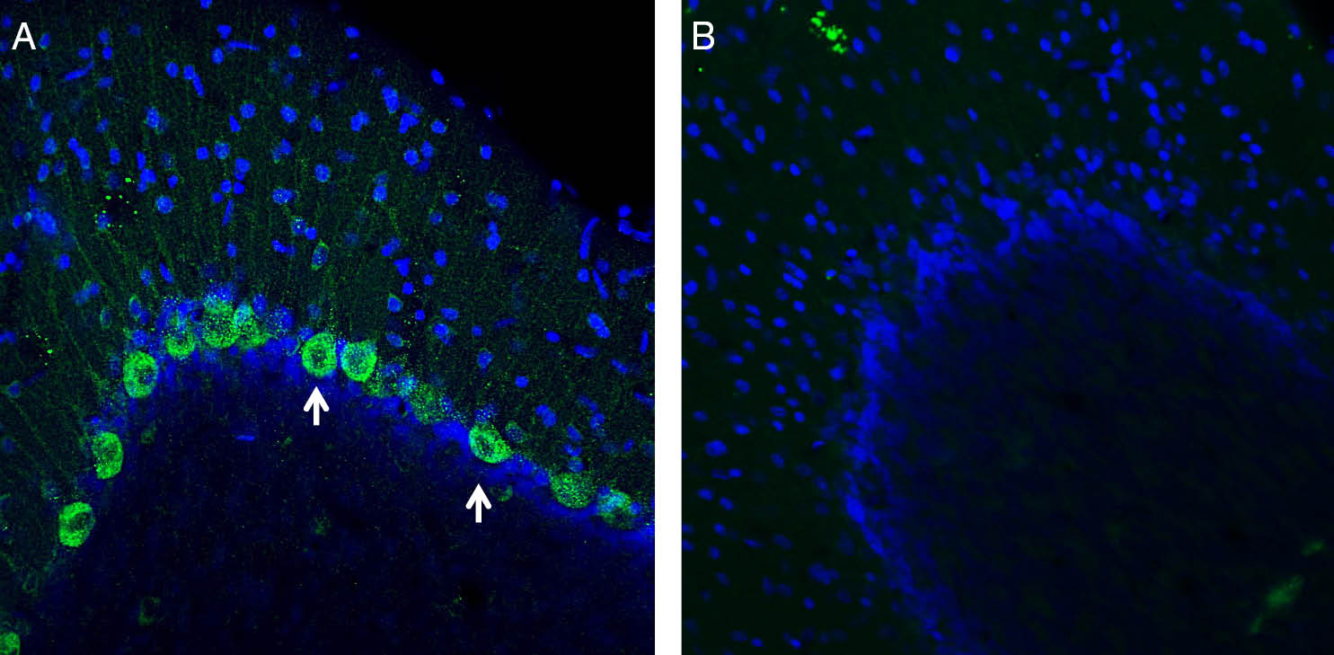 Expression of NMUR1 in rat cerebellum.
