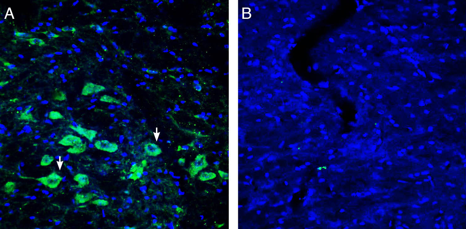 Expression of Platelet-activating factor receptor in rat substantia nigra pars compacta (SNC).