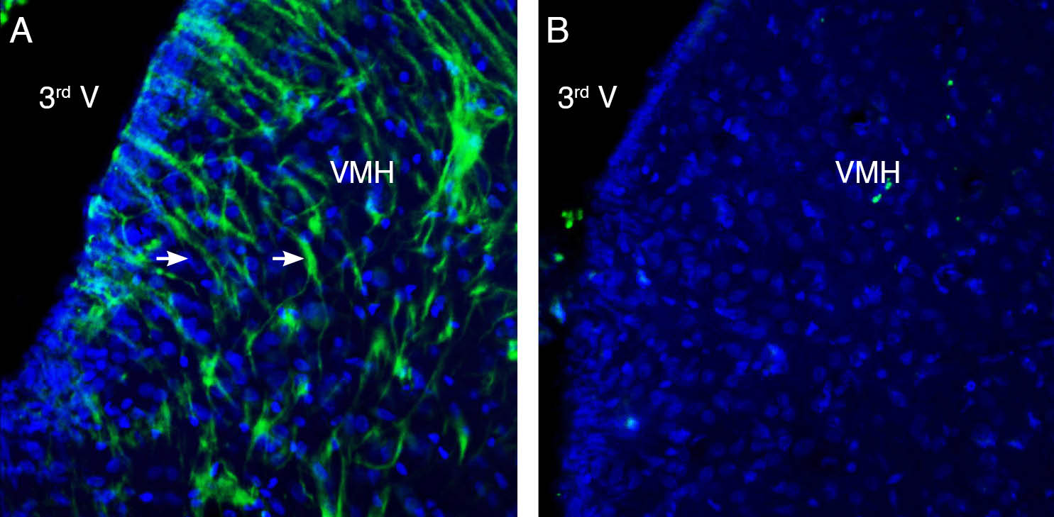 Expression of GPR139 in rat ventromedial hypothalamus (VMH).