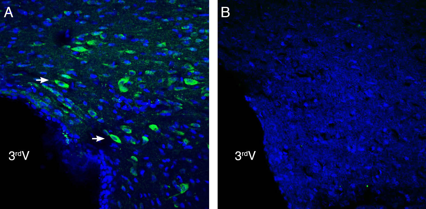 Expression of NGL-2/LRRC4 in rat hypothalamus.